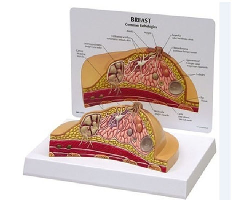 Pathological breast anatomy-0