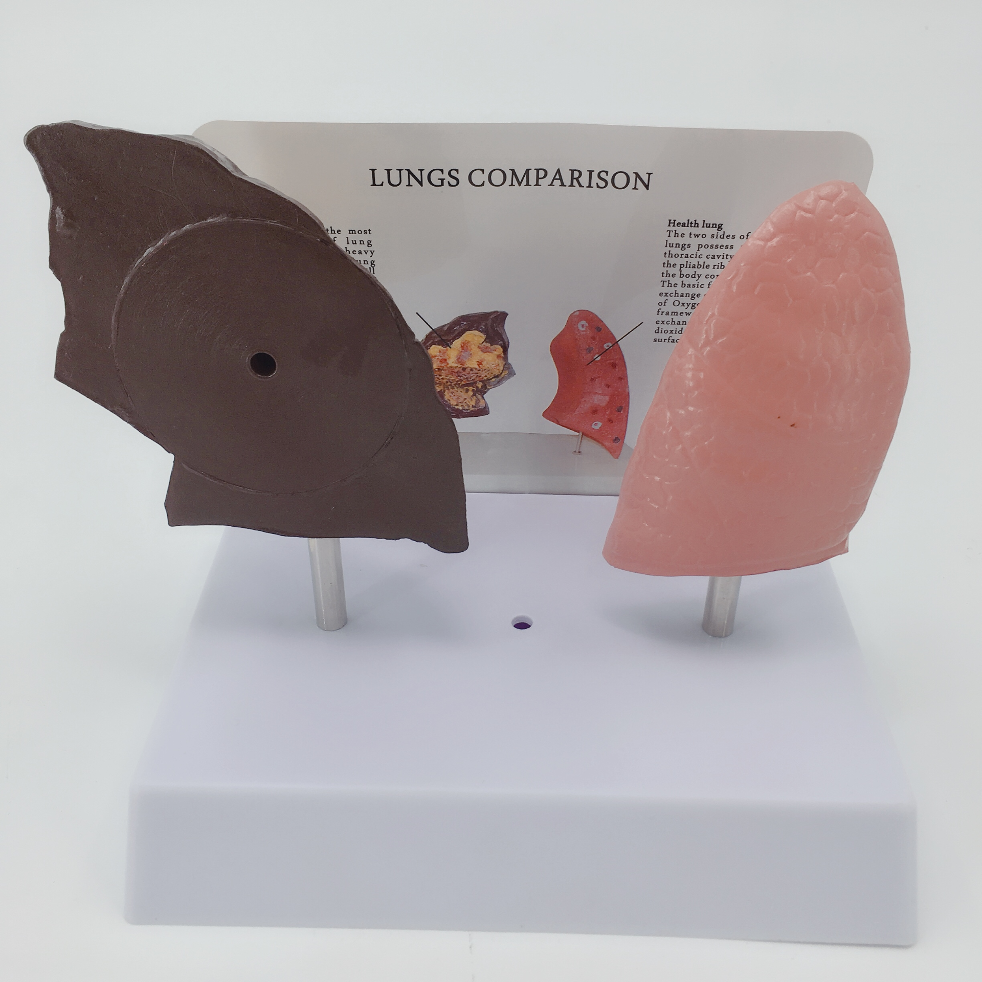 Lung contrast model-0