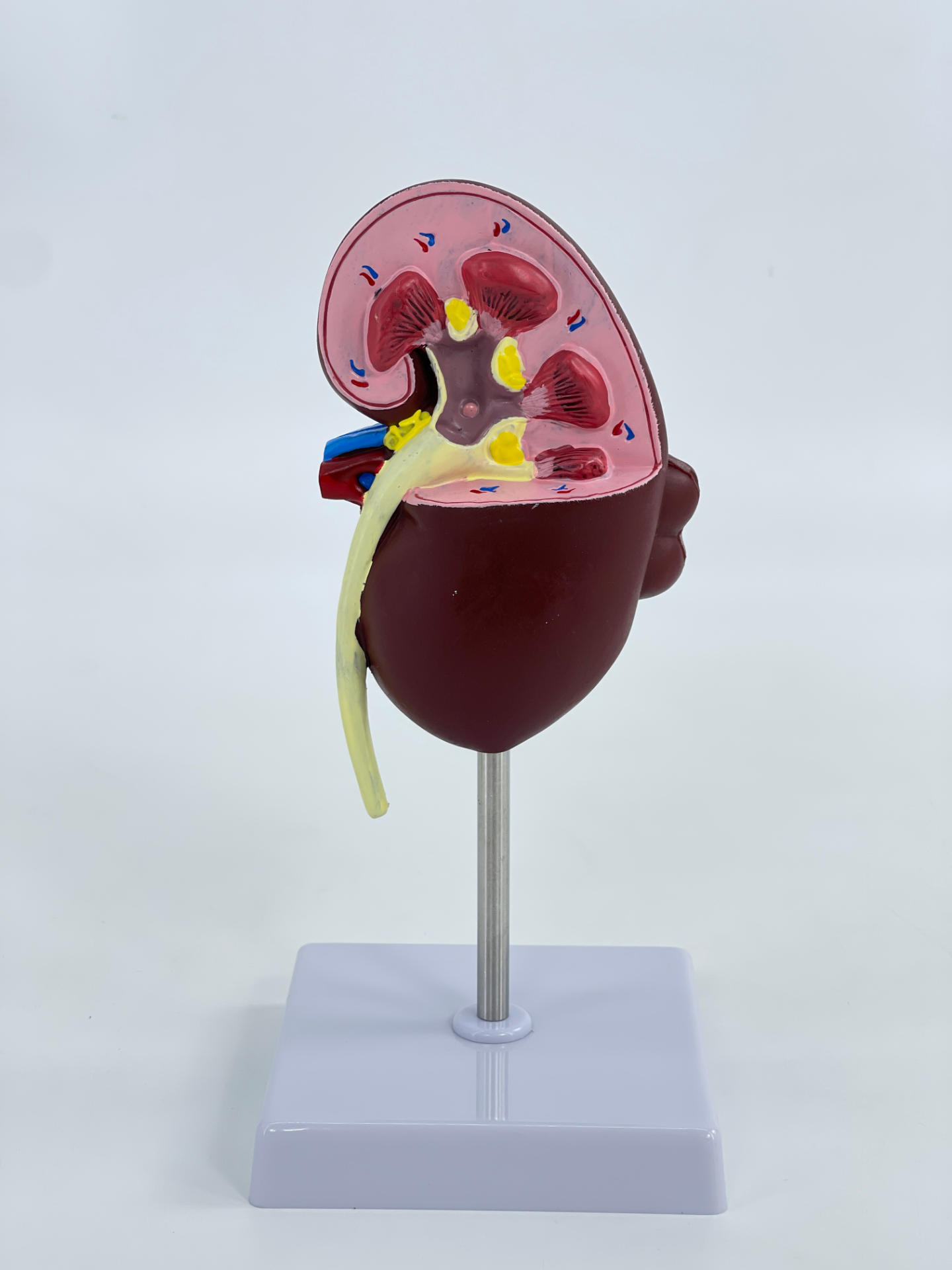 Pathological kidney-0