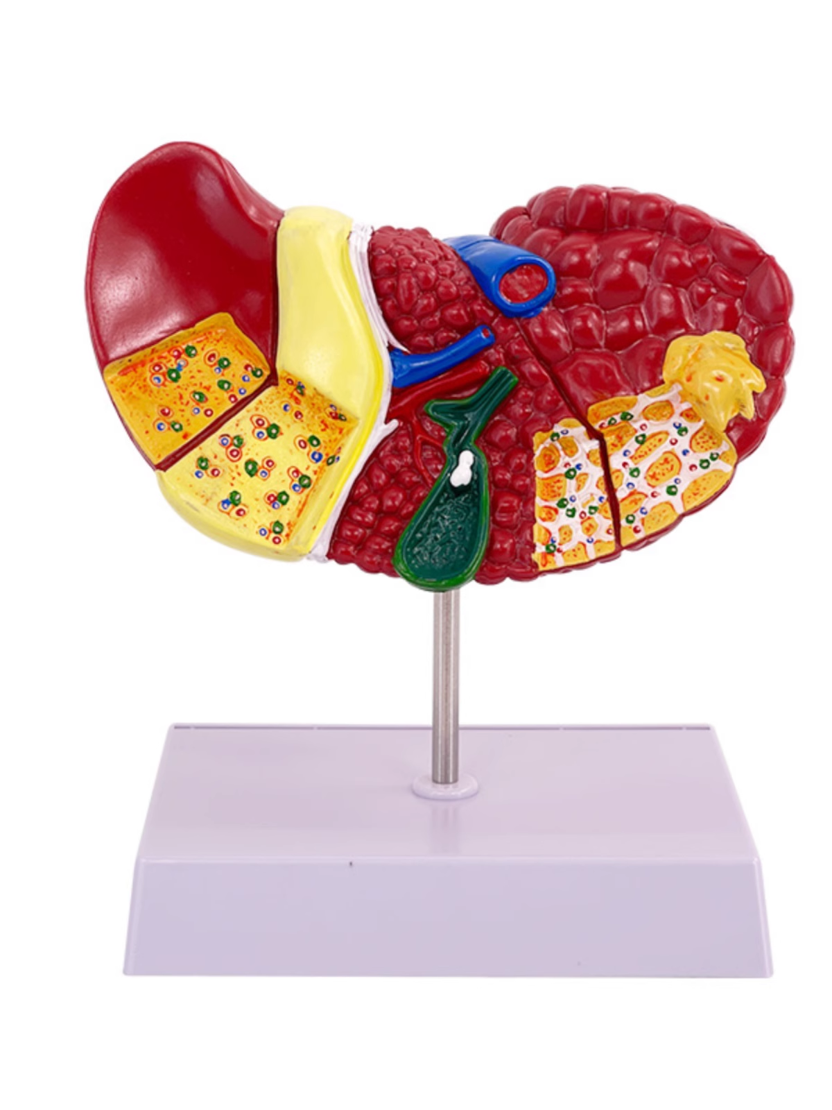Pathological color classification liver model-1