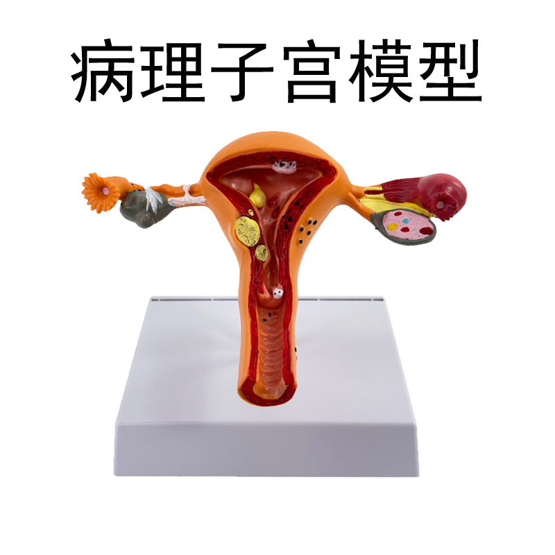 Pathological uterine model-0