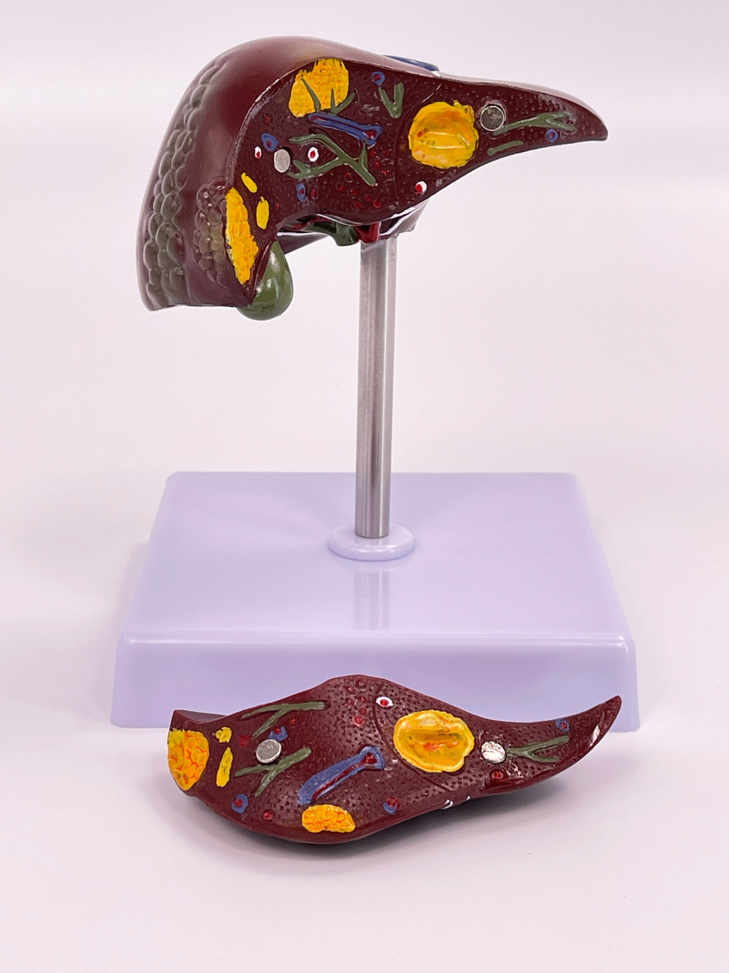 Pathological liver model-0