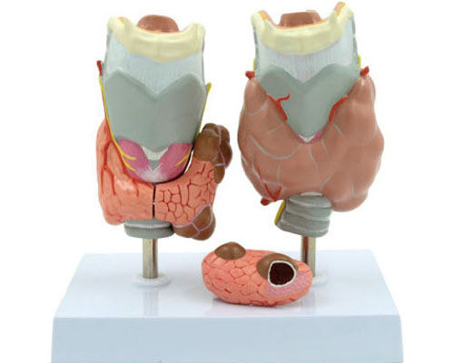 Pathological thyroid model-1