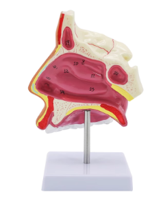 Nasal cavity with stent (send picture)-1