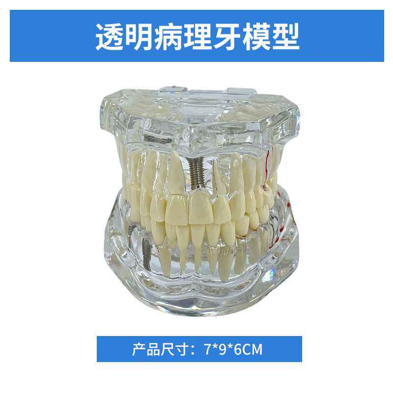 Transparent pathological tooth-0