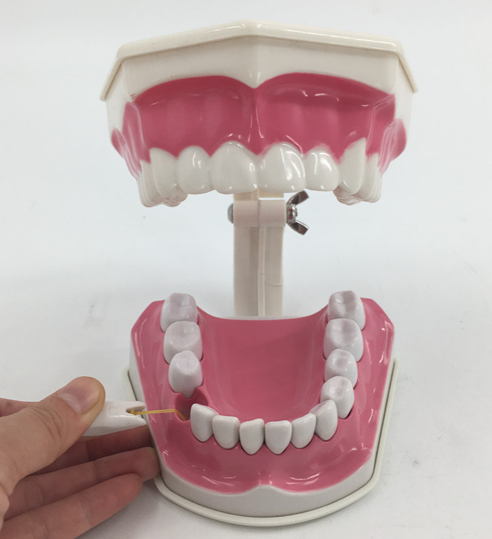 2x oral cavity (lower teeth removable)-0