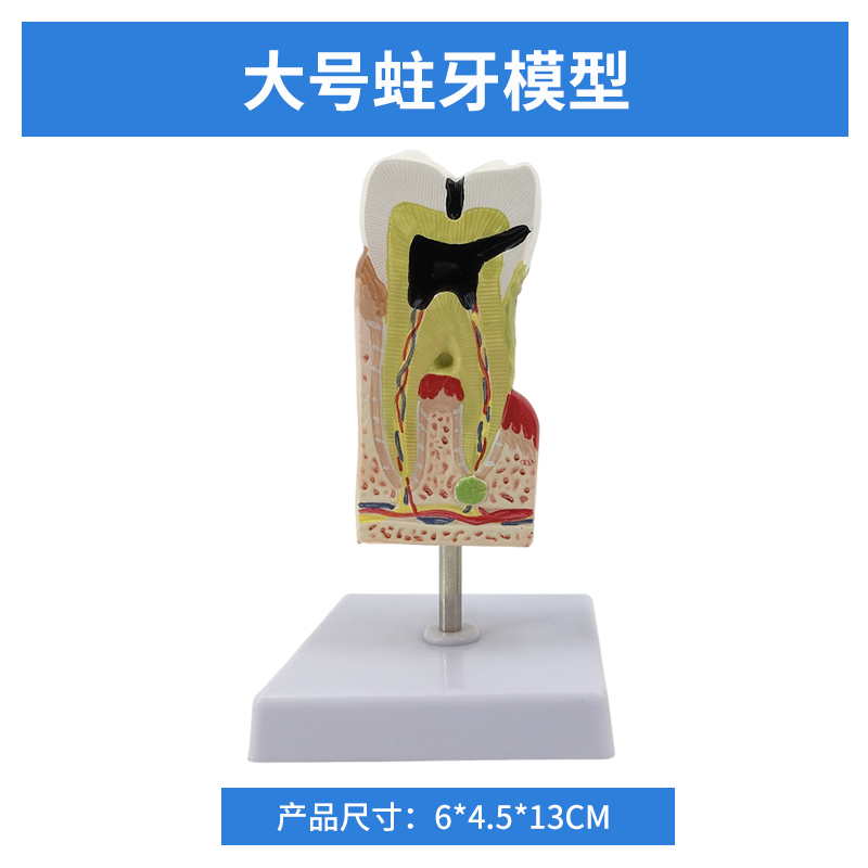 Large tooth decay model-0