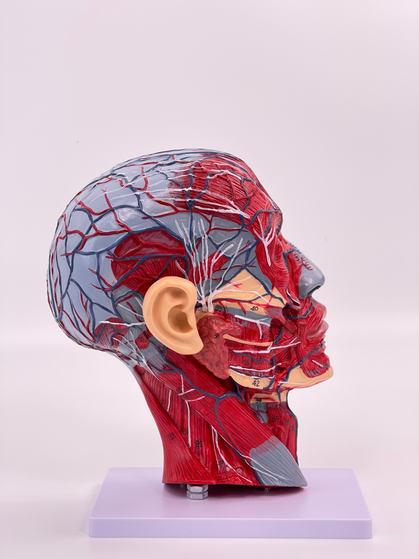 Advanced superficial head-0