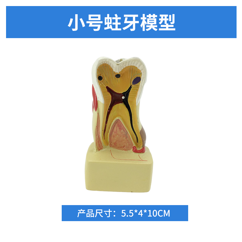 Small-sized decayed tooth model-0