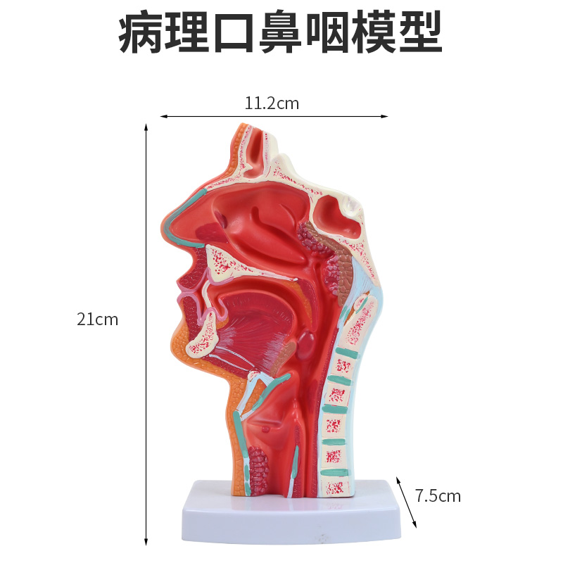 Pathological oral, nasal and pharyngeal model-0