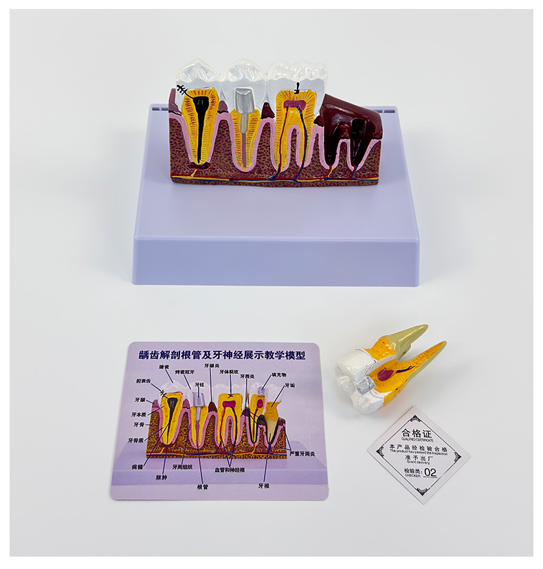 Comprehensive dental caries pathological model-1