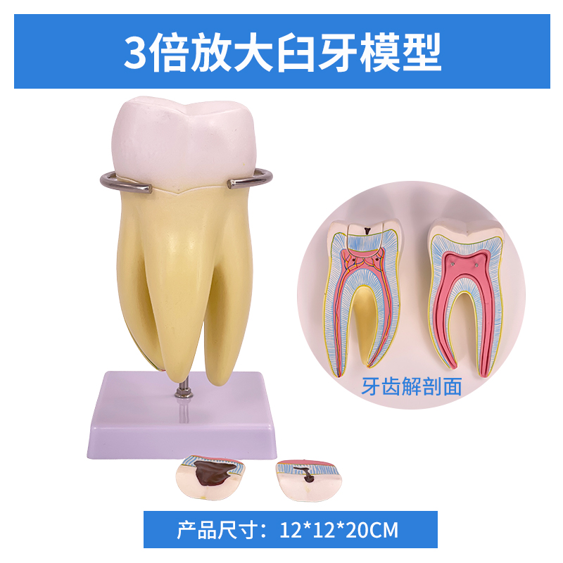 3x magnified molar (5 parts)-0