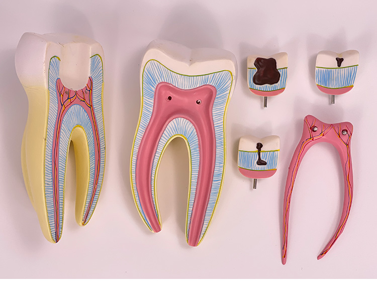3x magnified molar (5 parts)-1