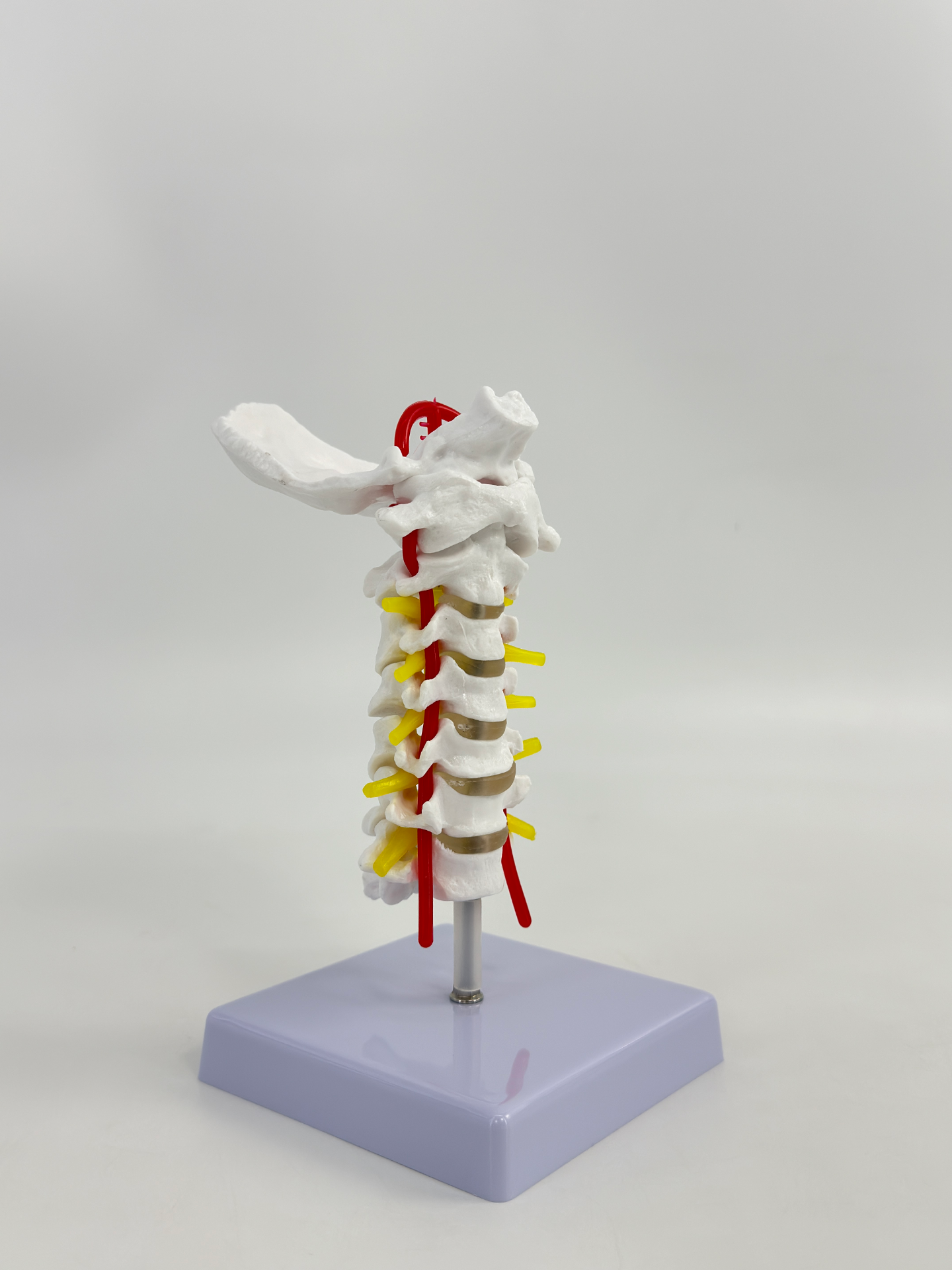 Cervical vertebral artery-1