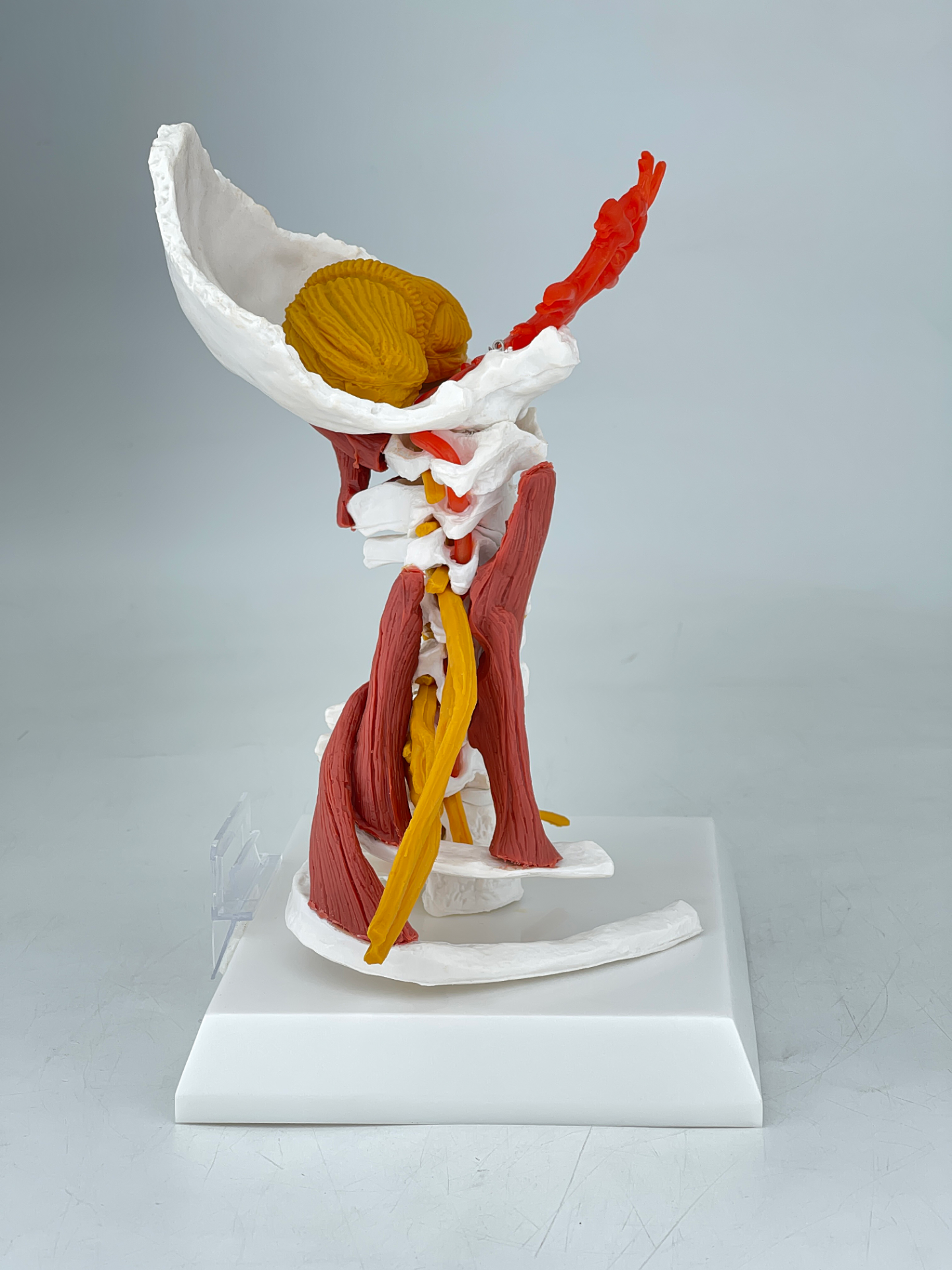 Cervical vertebral artery with nerve and muscle model (advanced version)-1
