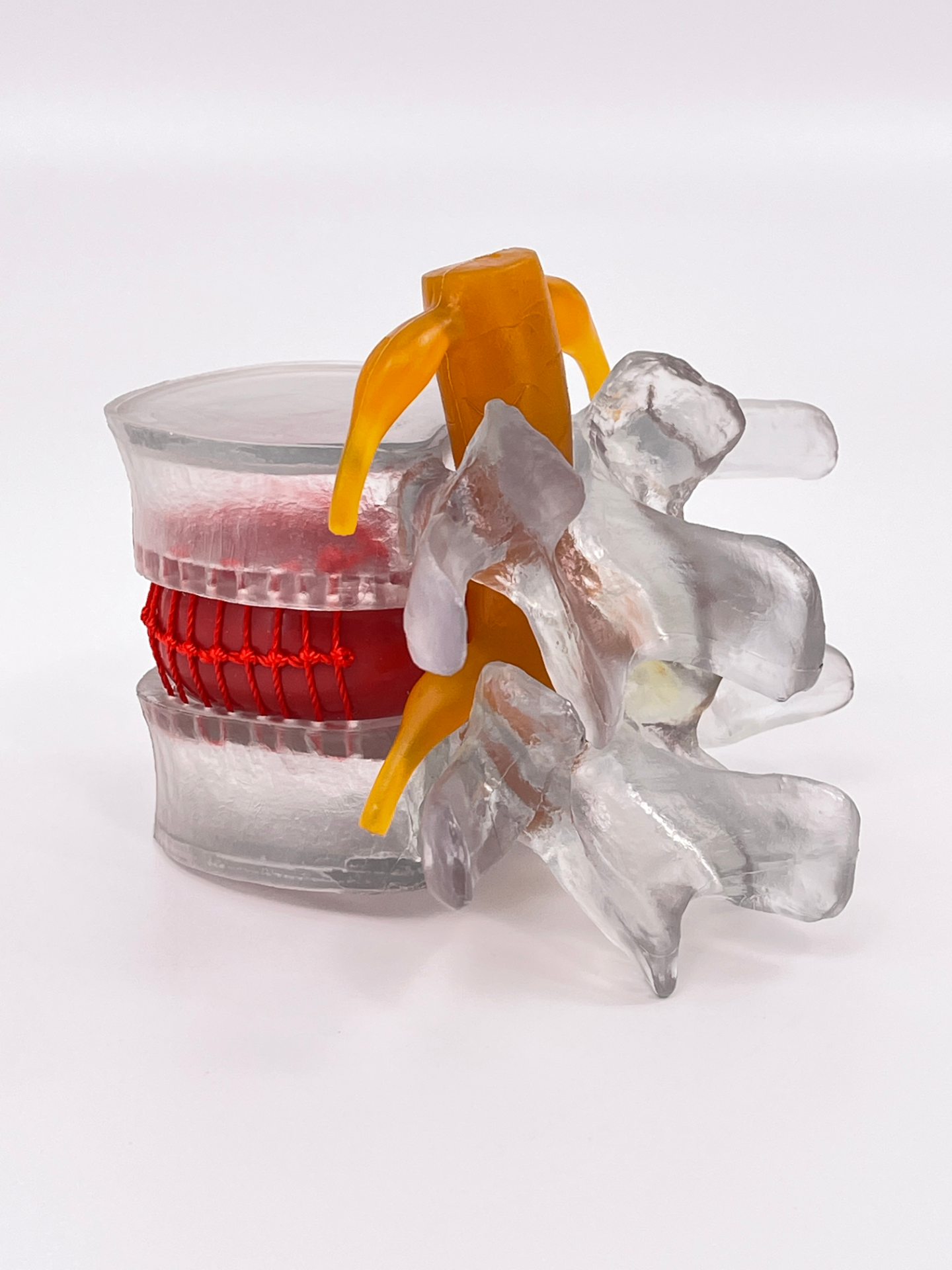 Lumbar intervertebral model (transparent color)-1