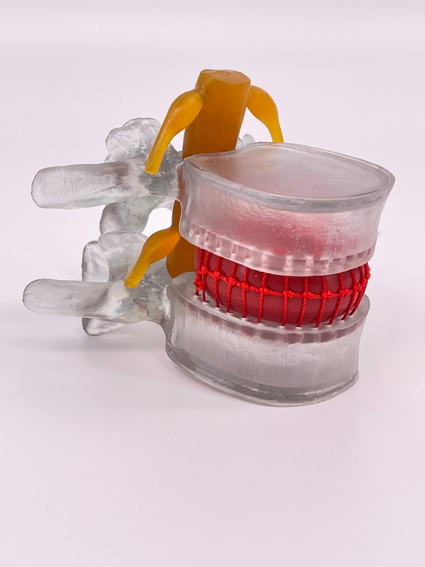 Lumbar intervertebral model (transparent color)-0