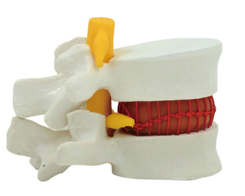 Lumbar intervertebral model (white)-0