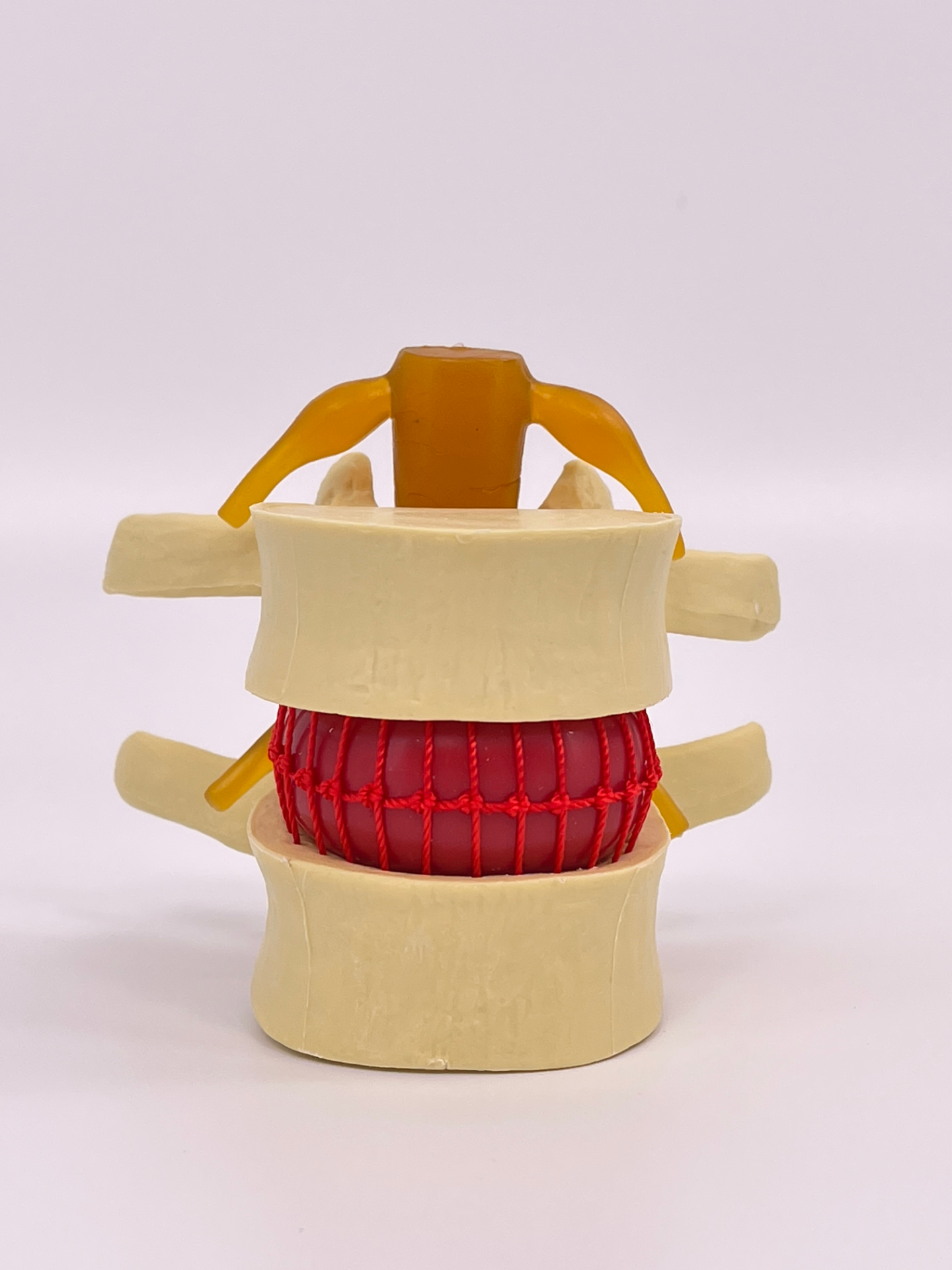Lumbar spine model (yellow)-0