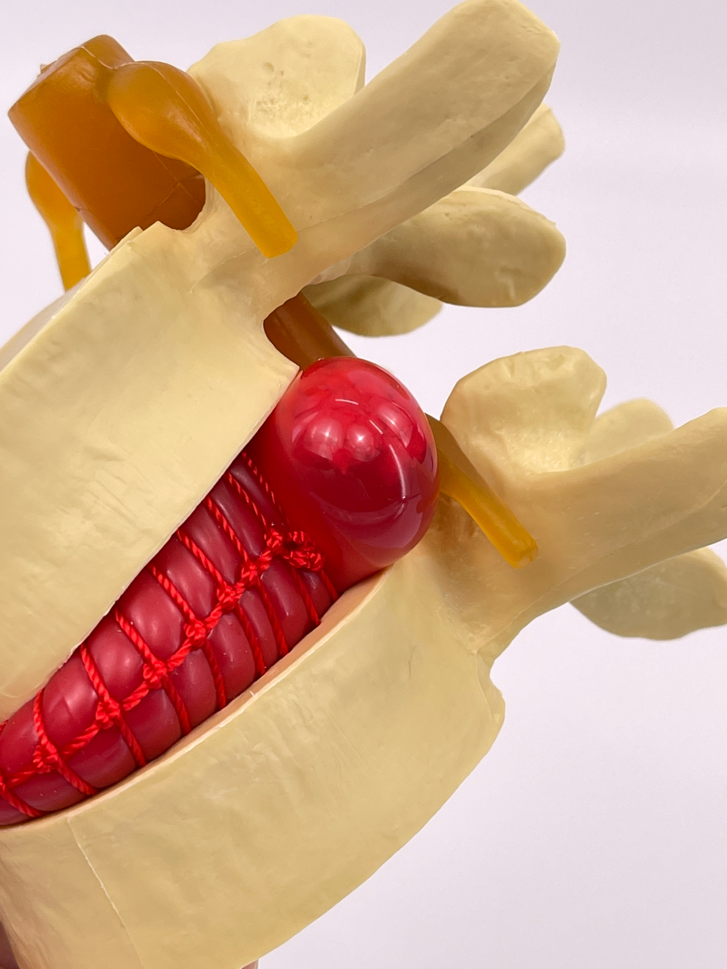Lumbar spine model (yellow)-1