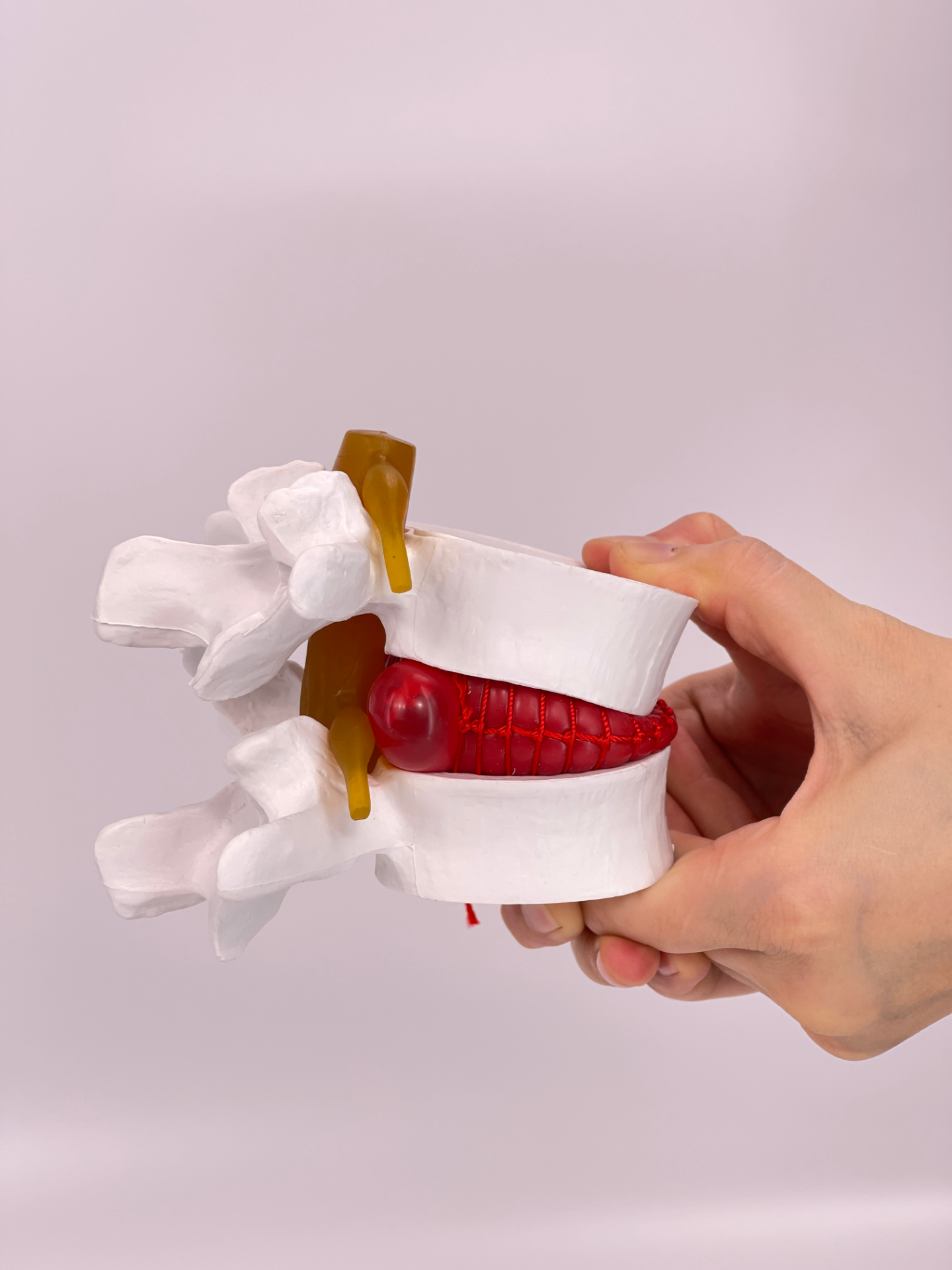 Lumbar intervertebral model (white)-1