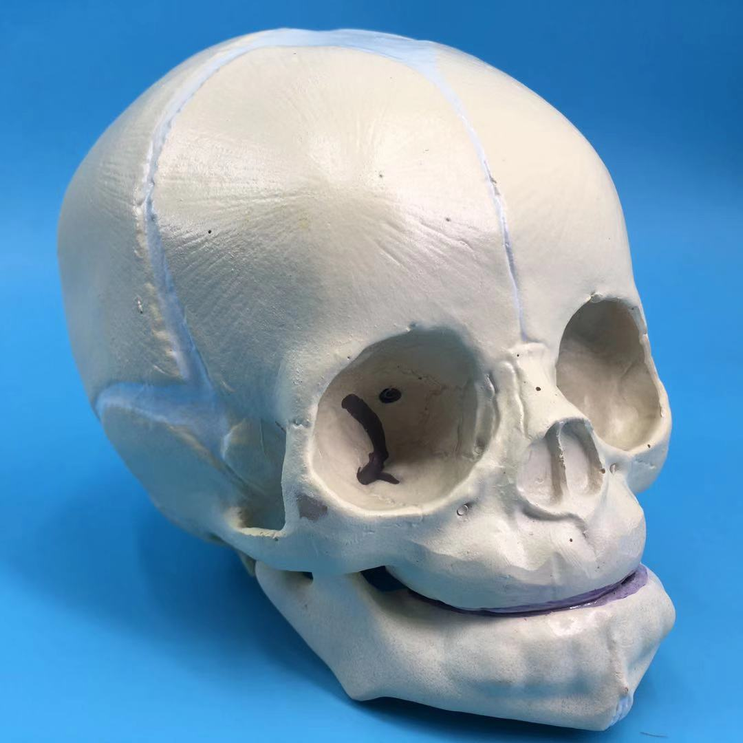 Infant skull-1
