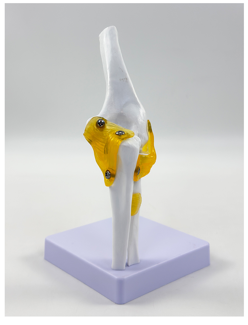 Elbow joint model (life-size)-1