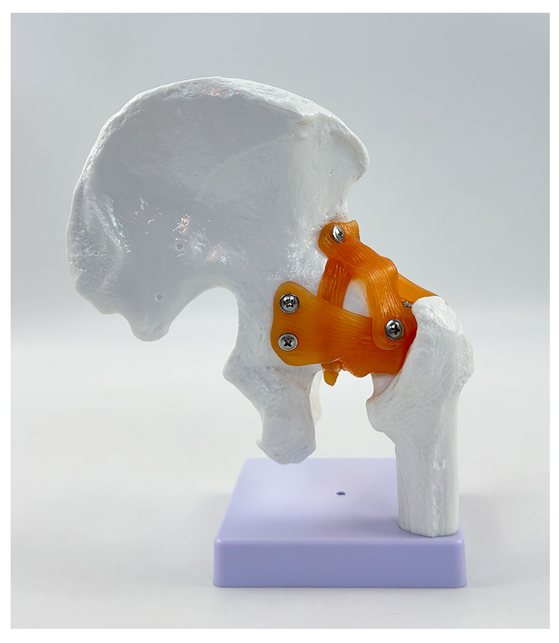 Hip joint model (life-size)-1