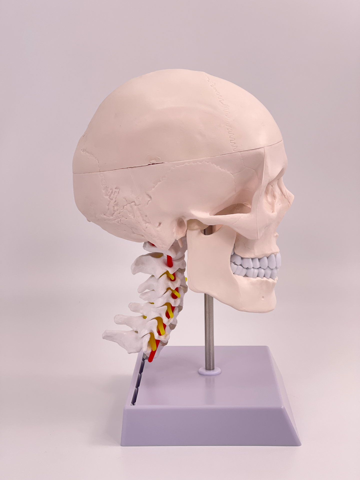 Completely white skull with cervical vertebrae-1