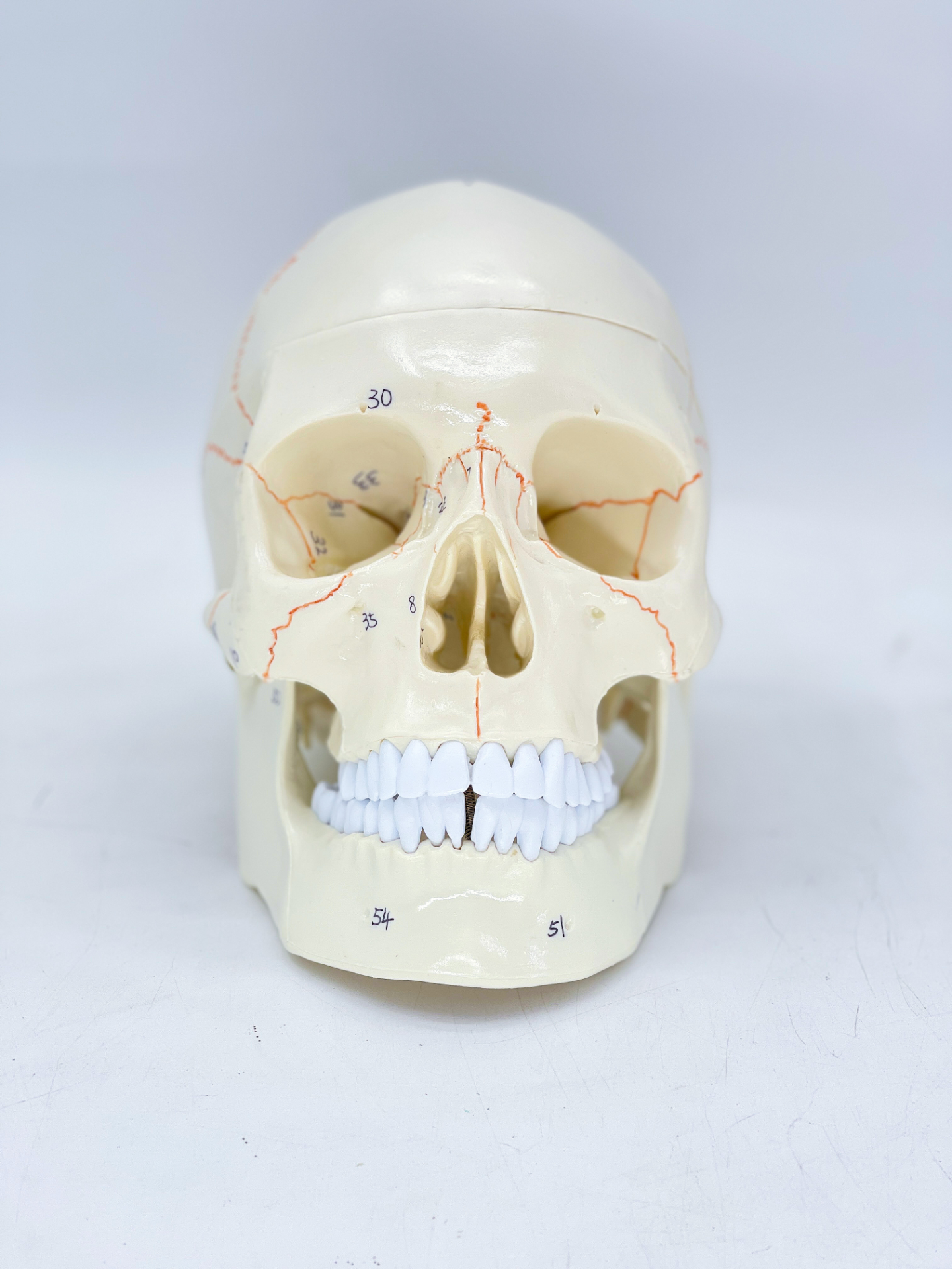 Sutural bones of the skull-0