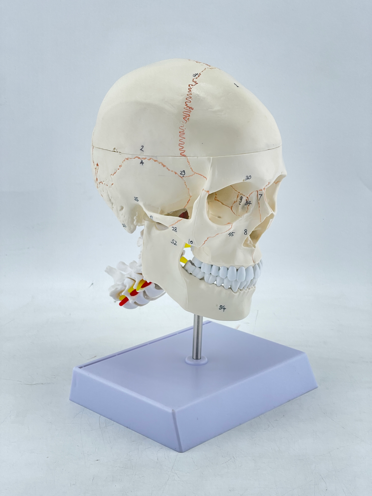 Suture lines of the skull, skull, and cervical vertebrae-0