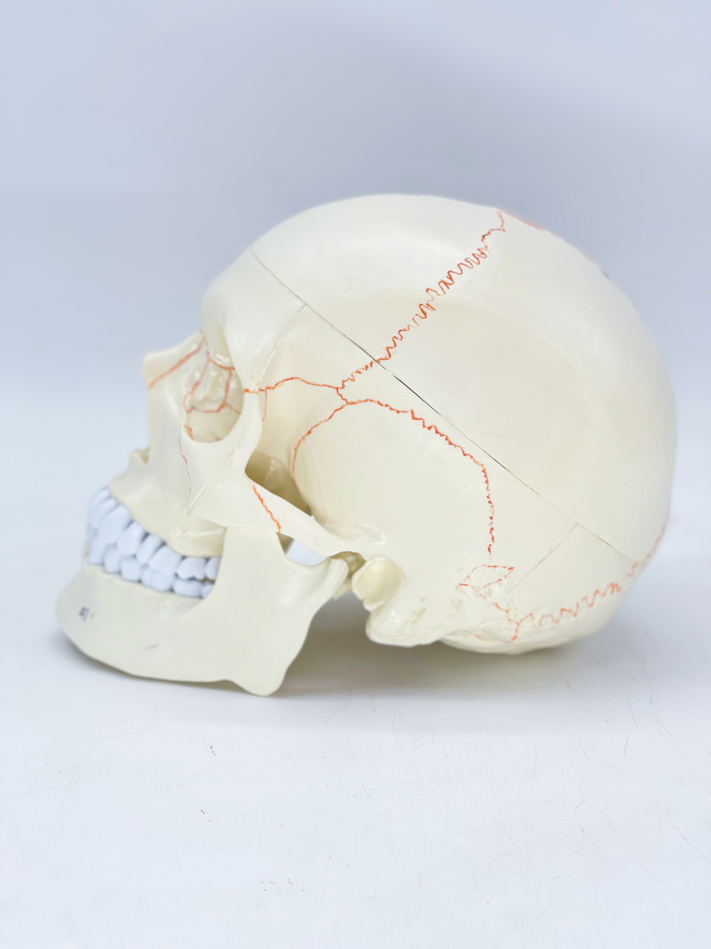 Sutural bones of the skull-1