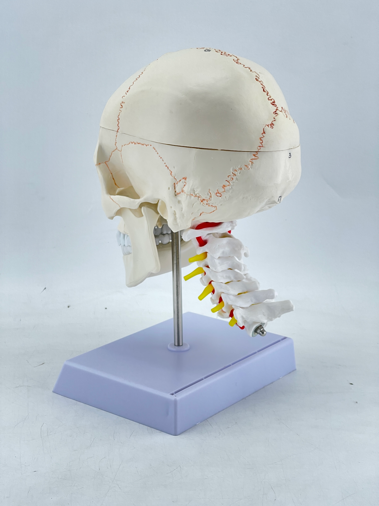 Suture lines of the skull, skull, and cervical vertebrae-1