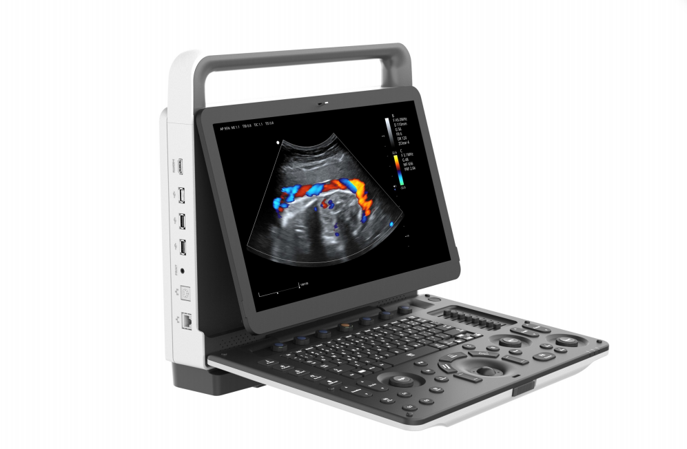 Portable Color Doppler Ultrasound Diagnostic System-0