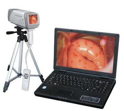 Notebook digital electronic colposcope-0
