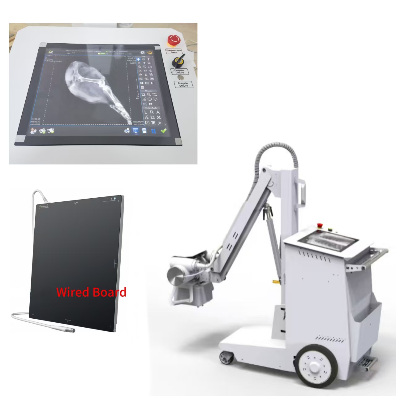 220V 40KW 500mAMobile Digital Radiography System-0