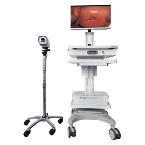 HD model HD 1080P digital electronic colposcope-0