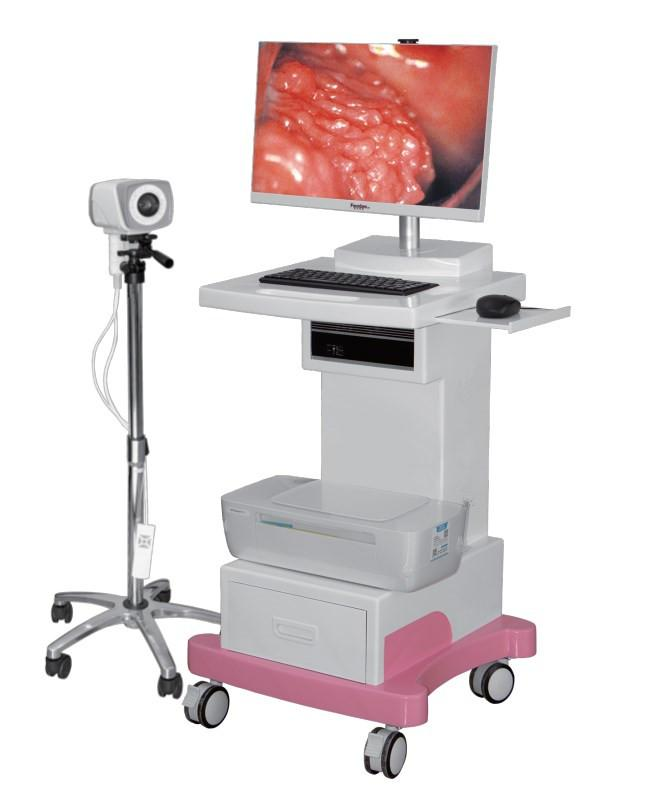 Standard digital electronic colposcope-0