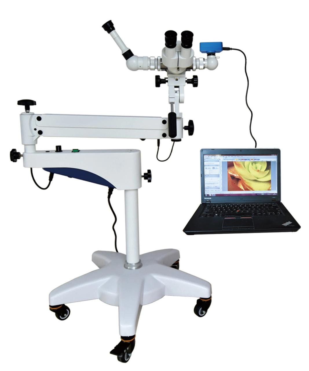 optical colposcope
