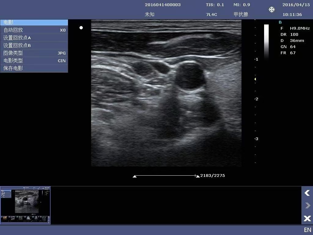 15-inch Color Doppler Ultrasound Diagnostic System-6