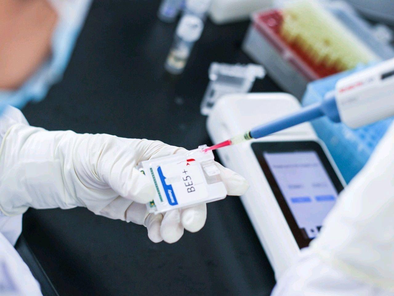 Blood gas & Electrolyte Analyzer (Electrode method)-2
