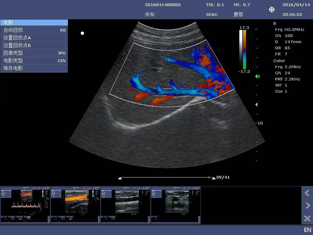 15-inch Color Doppler Ultrasound Diagnostic System-5