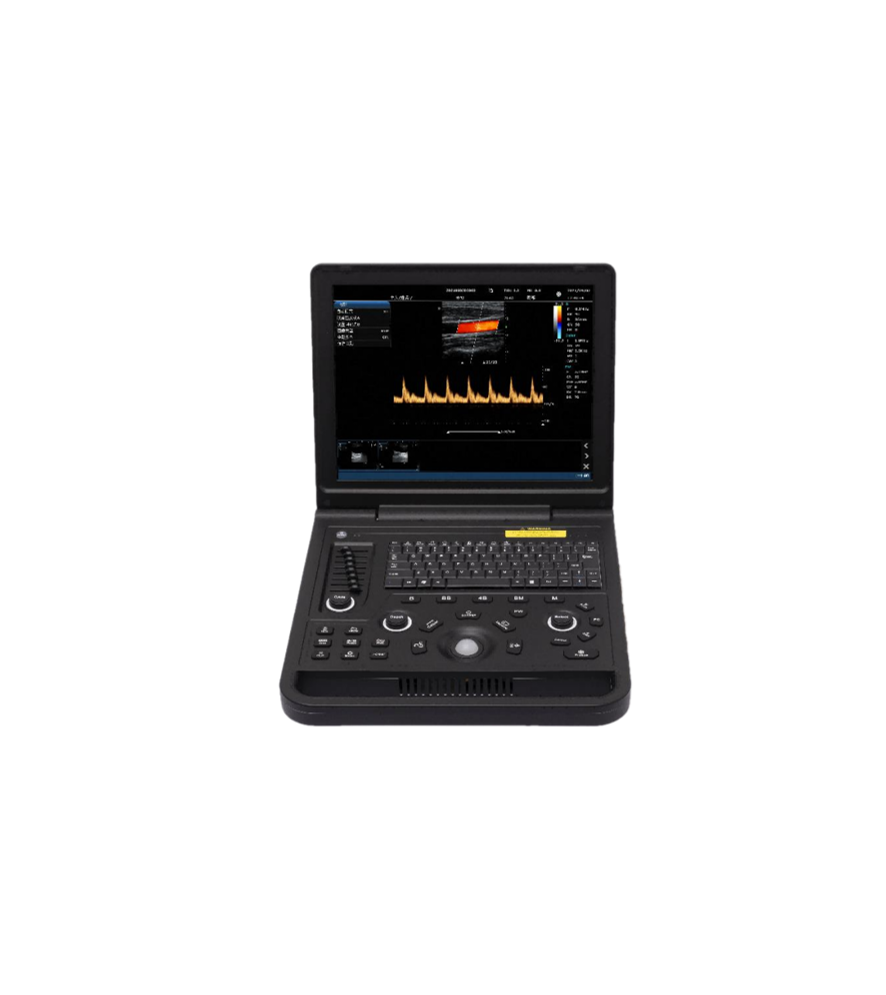 15-inch Color Doppler Ultrasound Diagnostic System-1