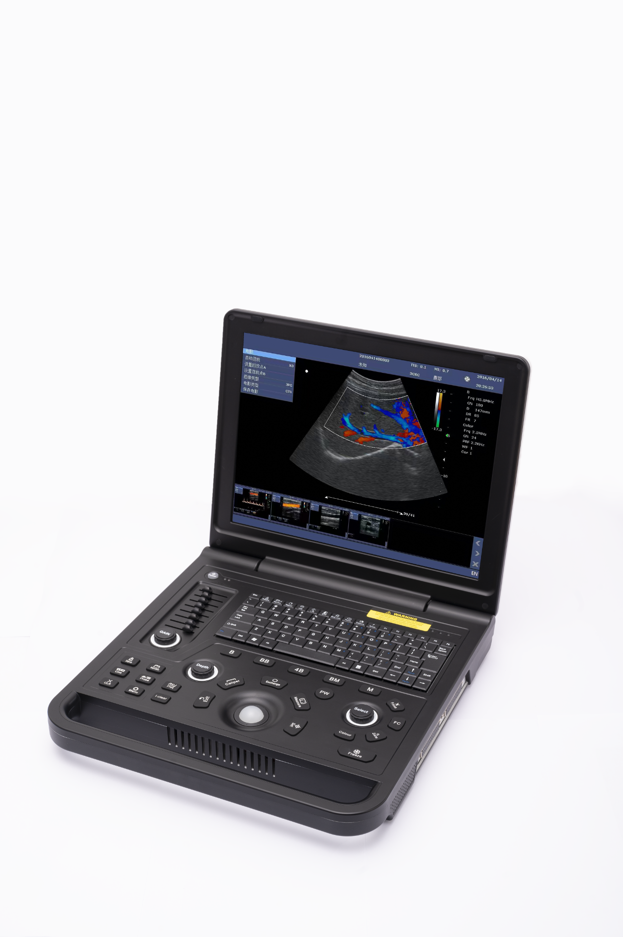 15-inch Color Doppler Ultrasound Diagnostic System-0