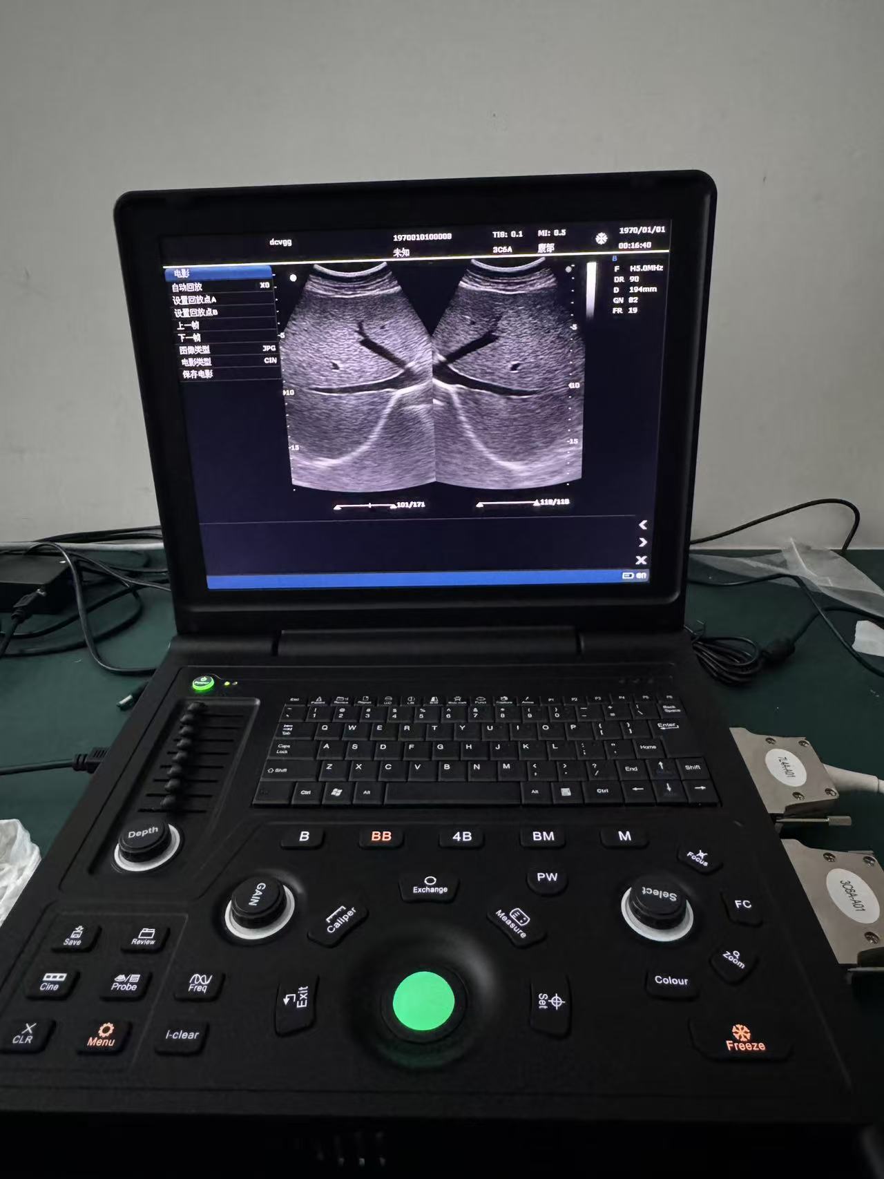 15-inch Color Doppler Ultrasound Diagnostic System-2