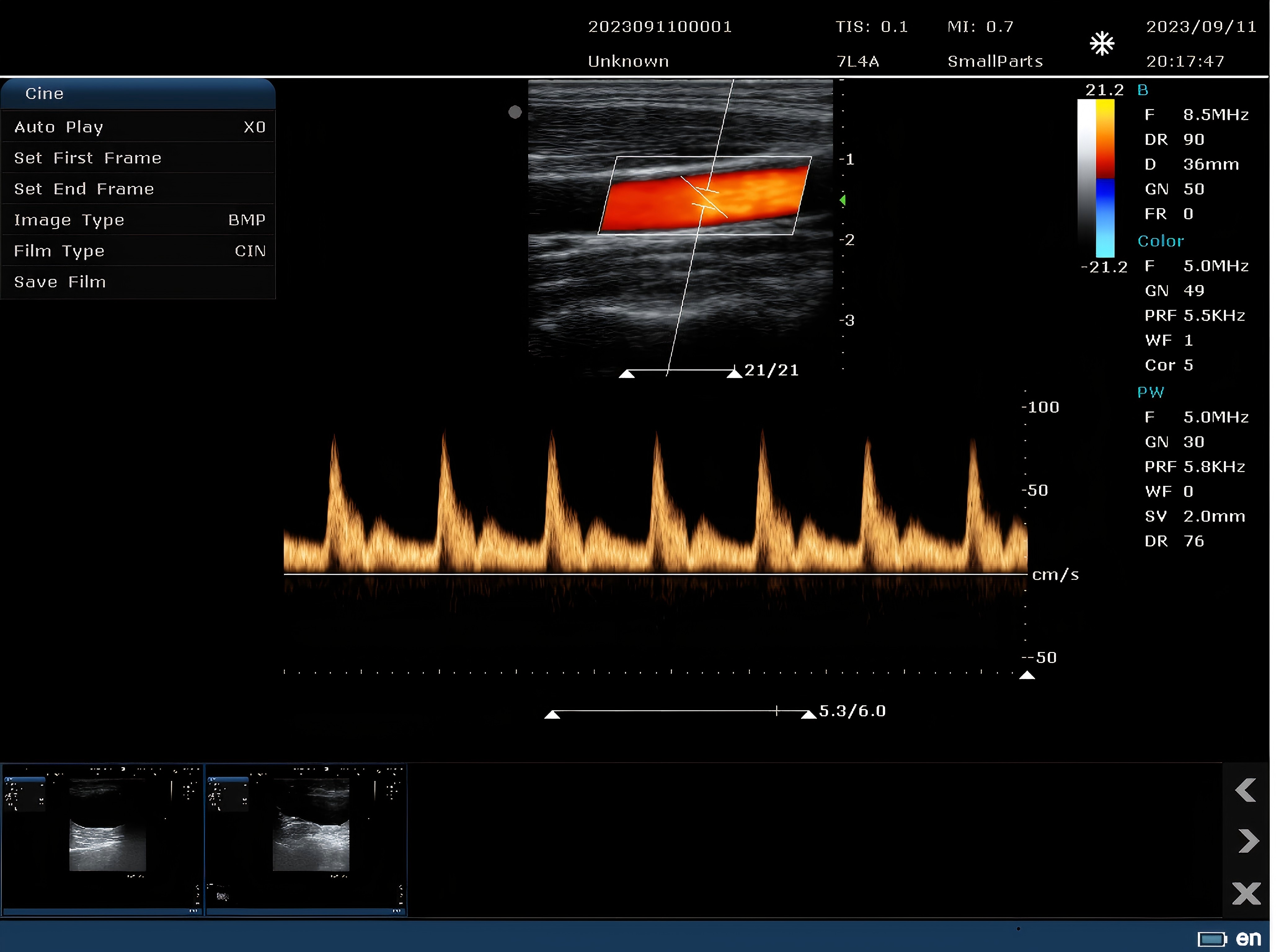 15-inch Color Doppler Ultrasound Diagnostic System-7