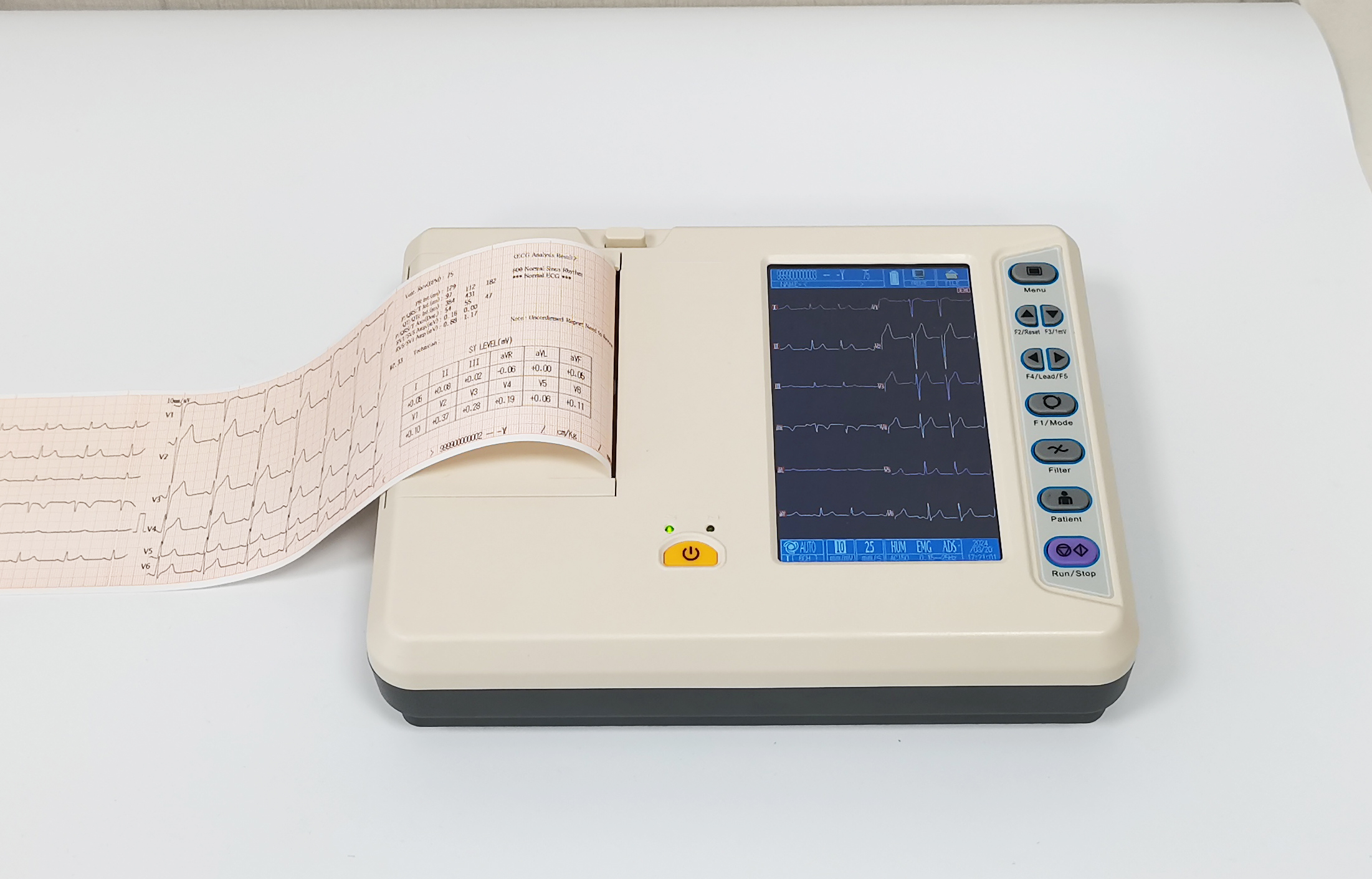 Electrocardi&oacute;grafo de 6 derivaciones-5