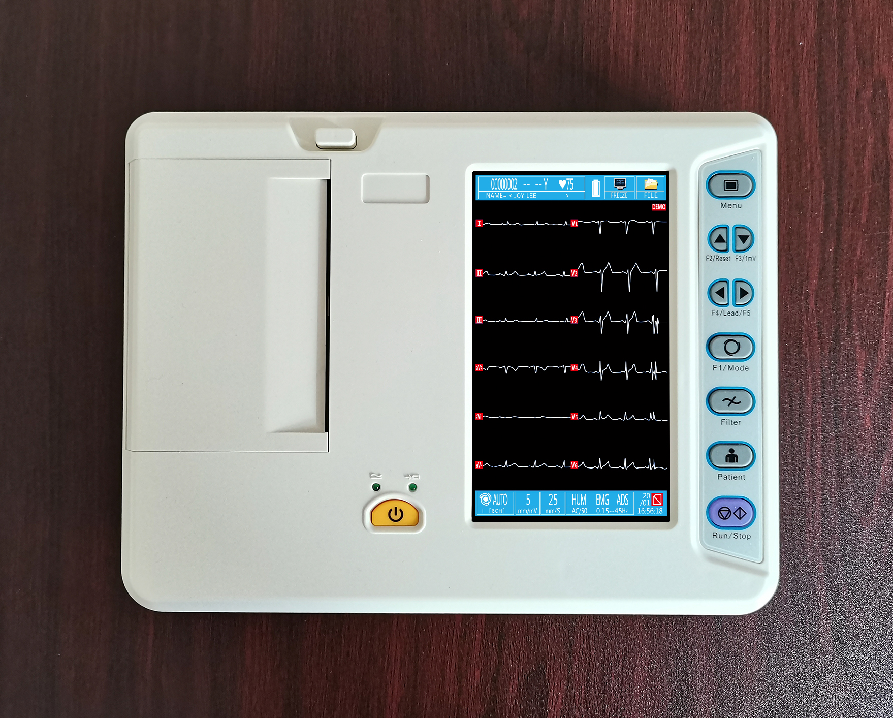 Electrocardi&oacute;grafo de 6 derivaciones-2