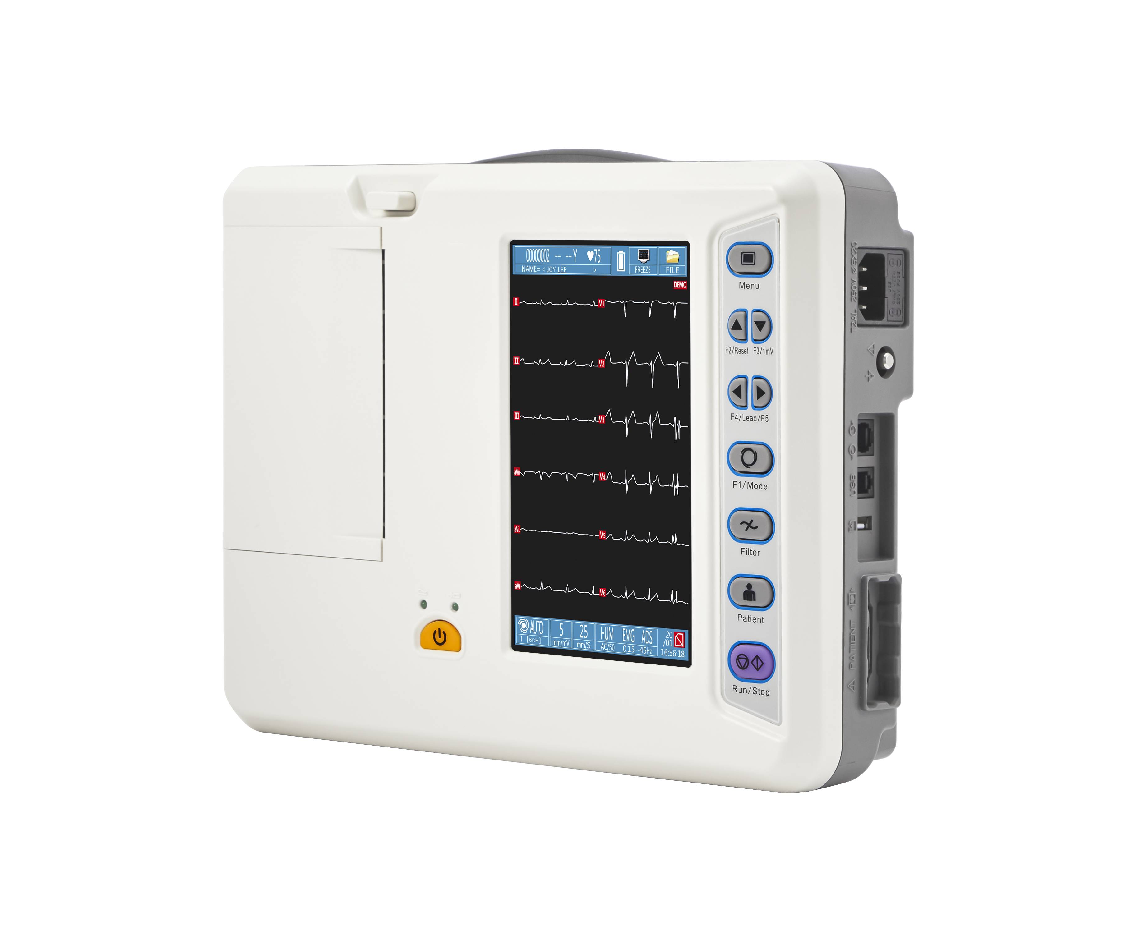 Electrocardi&oacute;grafo de 6 derivaciones-7