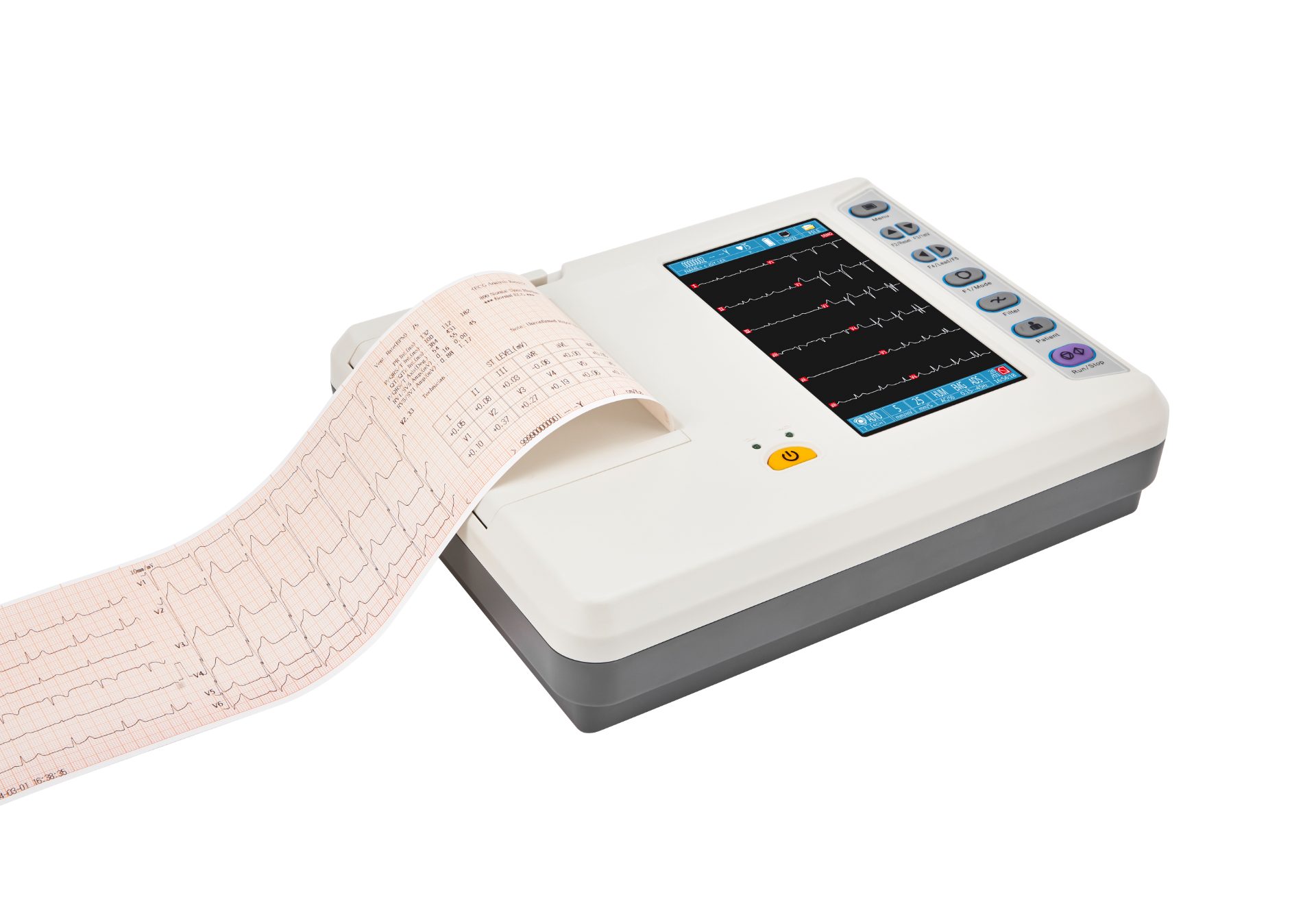 Electrocardi&oacute;grafo de 6 derivaciones-6